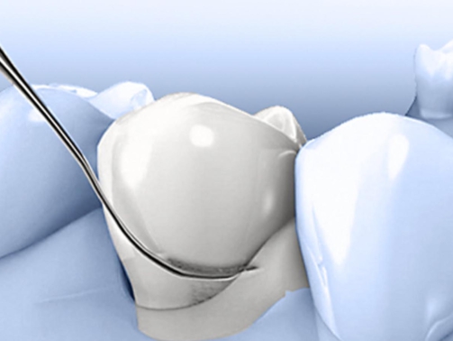 Paradontologie - mijn tand tandarts hengelo