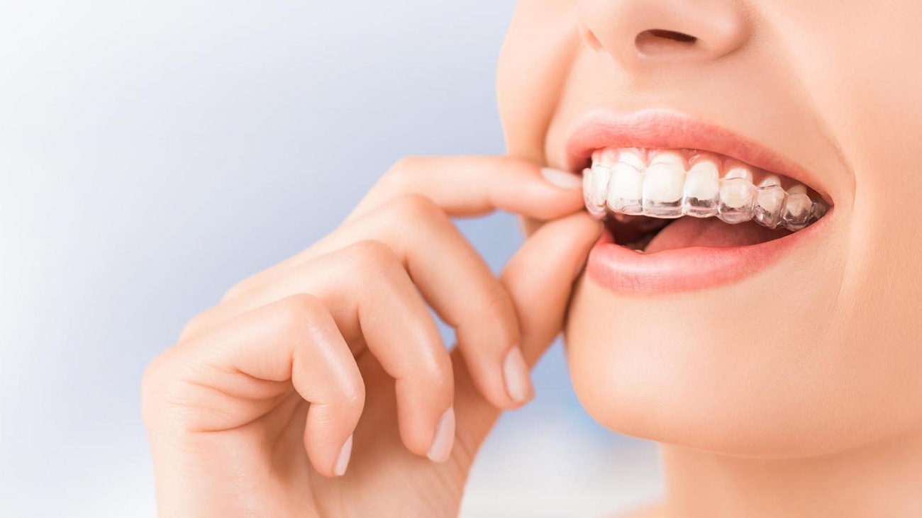orthodontie - mijn tand tandarts hengelo