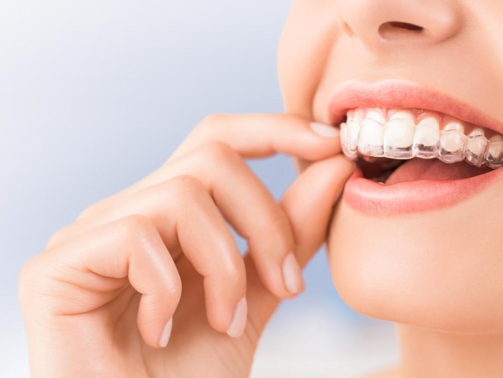 orthodontie - mijn tand tandarts hengelo