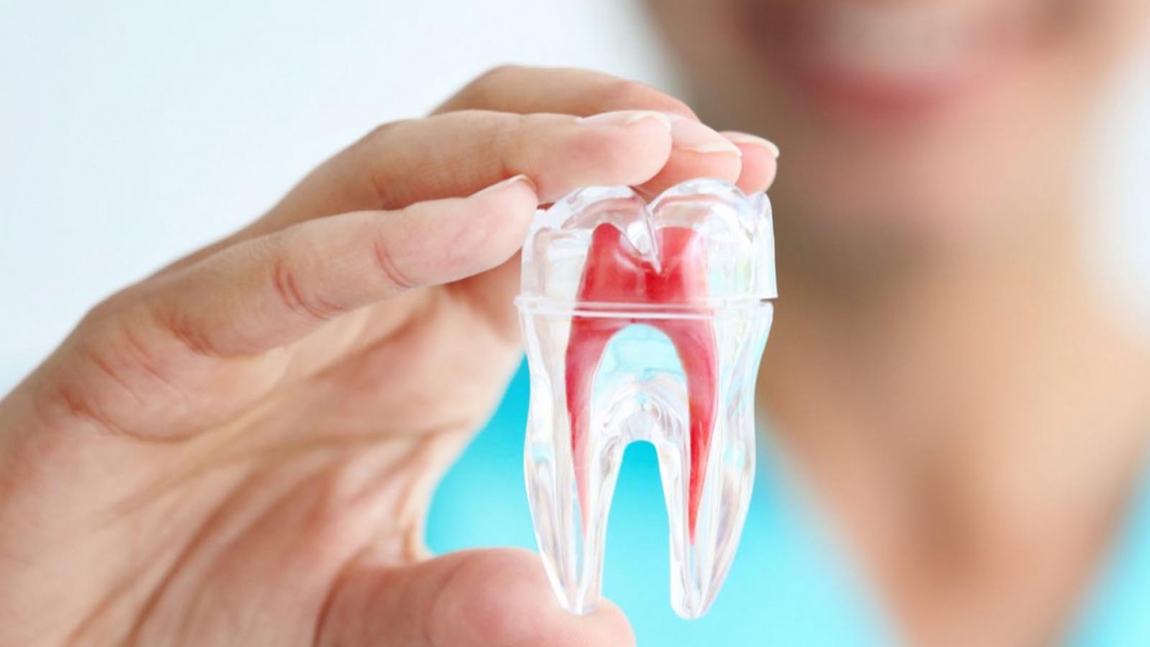 wortelkanaalbehandeling - Mijn tand tandarts hengelo